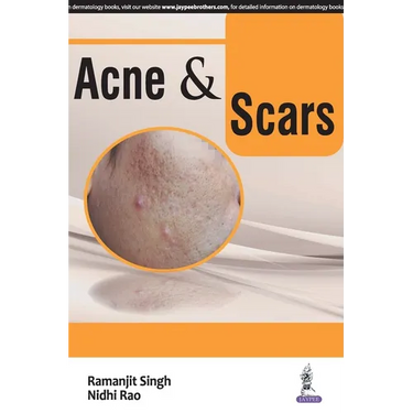 ACNE and SCARS