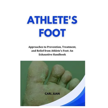 Athlete's Foot: Approaches to Prevention, Treatment, and Relief from Athlete's Foot: An Exhaustive Handbook