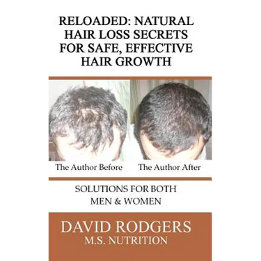 Reloaded: Natural Hair Loss Secrets for Safe, Effective Hair Growth