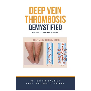 Deep Vein Thrombosis Demystified: Doctor's Secret Guide