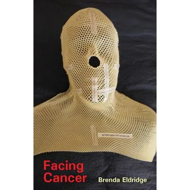 Facing Cancer