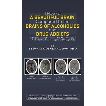 I Have a Beautiful Brain, Compared to the Brains of Alcoholics and Drug Addicts