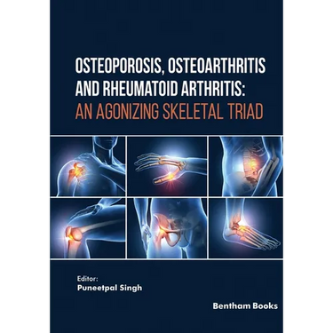 Osteoporosis, Osteoarthritis and Rheumatoid Arthritis: An Agonizing Skeletal Triad