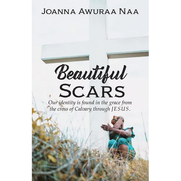 Beautiful Scars: Our Identity is Found in the Grace from the Cross of Calvary through Jesus