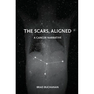 The Scars, Aligned