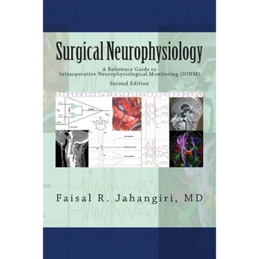 Surgical Neurophysiology - 2nd Edition: A Reference Guide to Intraoperative Neurophysiological Monitoring