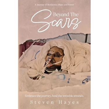 Beyond The Scars: A Journey of Resilience, Hope, and Power