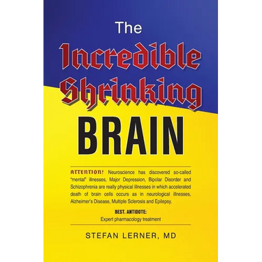 The Incredible Shrinking Brain