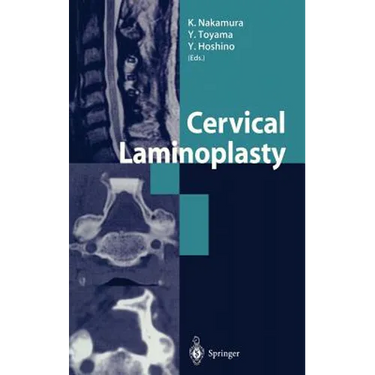 Cervical Laminoplasty