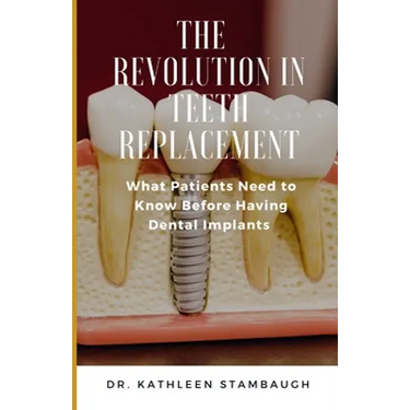 The Revolution in Teeth Replacement: What Patients Need to Know Before Having Dental Implants