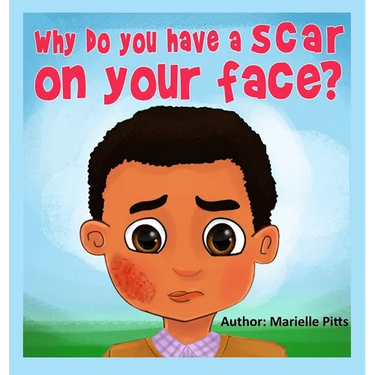 Why do you have a scar on your face?