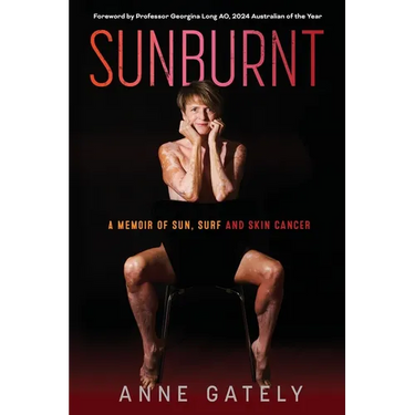Sunburnt: A memoir of sun, surf and skin cancer