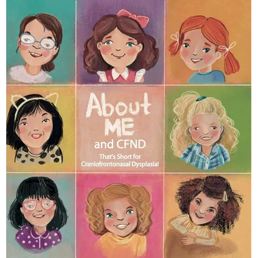 About Me and CFND: That's Short for Craniofrontonasal Dysplasia