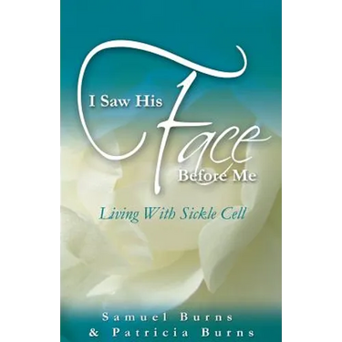 I Saw His Face Before Me - Living with Sickle Cell Anemia