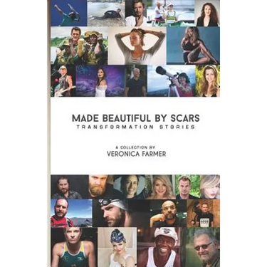 Made Beautiful by Scars: Transformation Stories