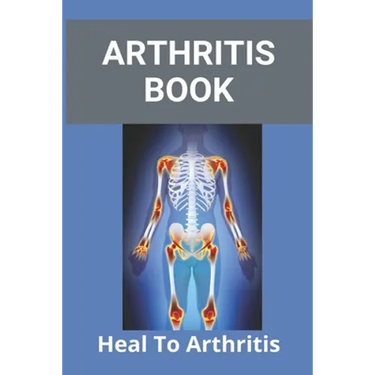 Arthritis Book: Heal To Arthritis: Rheumatoid Arthritis Treatment