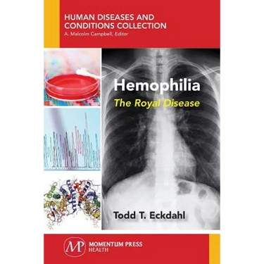 Hemophilia: The Royal Disease