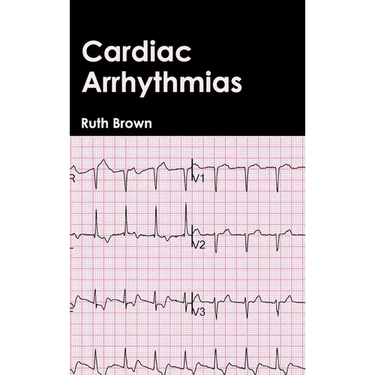 Cardiac Arrhythmias