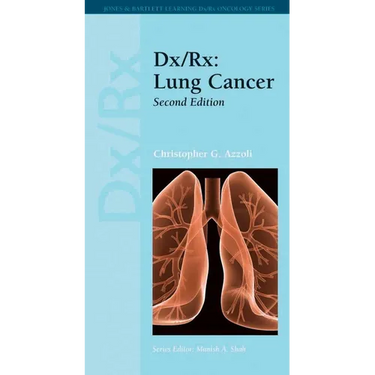 DX/Rx: Lung Cancer: Lung Cancer
