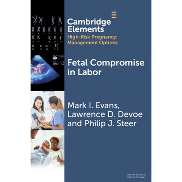 Fetal Compromise in Labor