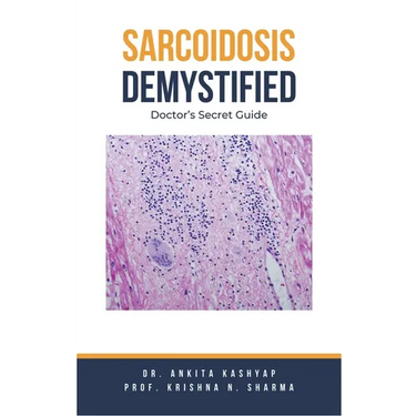 Sarcoidosis Demystified: Doctor's Secret Guide