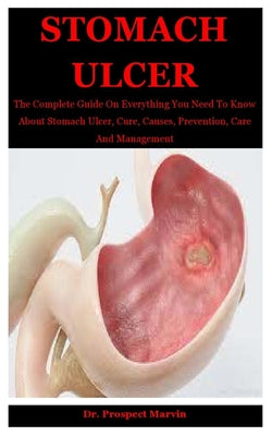 Stomach Ulcer: The Complete Guide On Everything You Need To Know About Stomach Ulcer, Cure, Causes, Prevention, Care And Management - Paperback by Books by splitShops