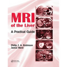 MRI of the Liver: A Practical Guide