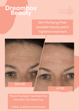 Skin Plumping Forehead Mask [Reusable] by Dreambox Beauty