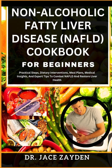 Non-Alcoholic Fatty Liver Disease (Nafld) Cookbook for Beginners: Practical Steps, Dietary Interventions, Meal Plans, Medical Insights, And Expert Tip - Paperback by Books by splitShops