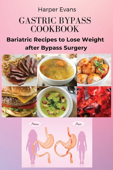 Gastric Bypass Cookbook: Bariatric Recipes to Lose Weight after Bypass Surgery - Paperback by Books by splitShops