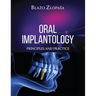 Oral Implantology: Principles and Practice