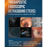 Therapeutic Endoscopic Ultrasound (TEUS)
