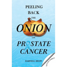 Peeling Back the Onion on Prostate Cancer