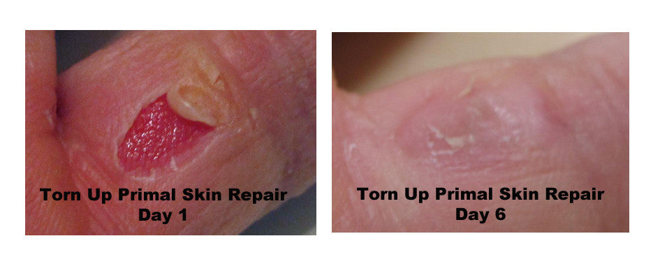 Torn Up Skin Repair by Primal Life Organics #1 Best Natural Dental Care