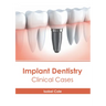 Implant Dentistry: Clinical Cases