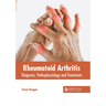 Rheumatoid Arthritis: Diagnosis, Pathophysiology and Treatment