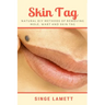 Skin Tag: Natural DIY Methods of removing Mole, Wart and Skin Tag