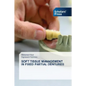 Soft Tissue Management in Fixed Partial Dentures