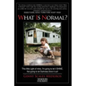 What Is Normal?