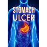 Stomach Ulcer: Treatment in 60 days!: Stomach Ulcer treatment
