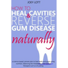 How to Heal Cavities and Reverse Gum Disease Naturally: a science-based, proven plan to heal teeth and gums using nutrition, balancing the metabolism,