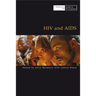 HIV and AIDS