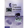 Early Pregnancy Ultrasound: A Practical Guide