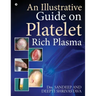 An Illustrative Guide on Platelet Rich Plasma