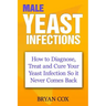Male Yeast Infections: How to Diagnose, Treat and Cure Your Yeast Infection So it Never Comes Back
