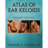 Atlas of Ear Keloids - Second Edition