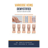 Varicose Veins Demystified: Doctor's Secret Guide