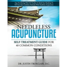 Needleless Acupuncture: Self-treatment guide for 40 common conditions