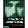 Craniofacial Identification