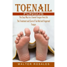 Toenail Fungus: The Easy Way to a Toenail Fungus-free Life (The Treatment and Cure of Toe Nail and Fingernail Fungus)